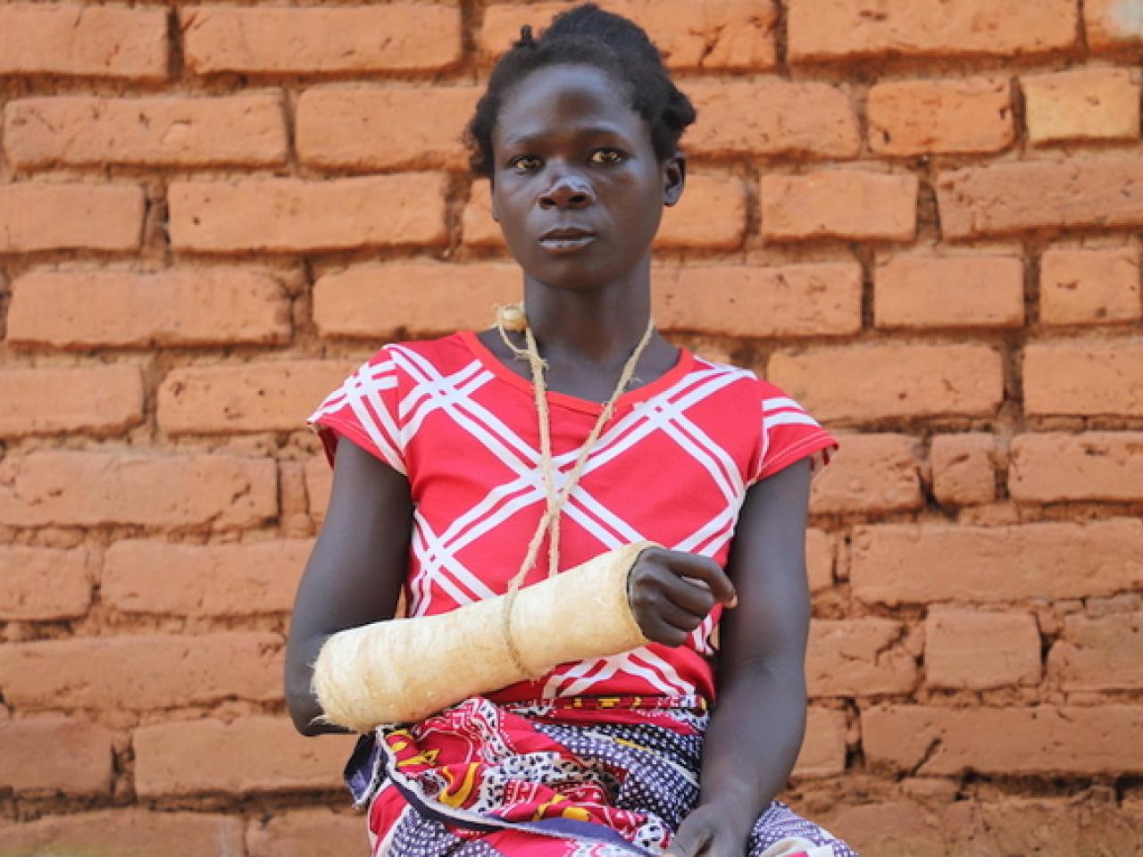 A young woman stands against a brick wall with her arm in a cast