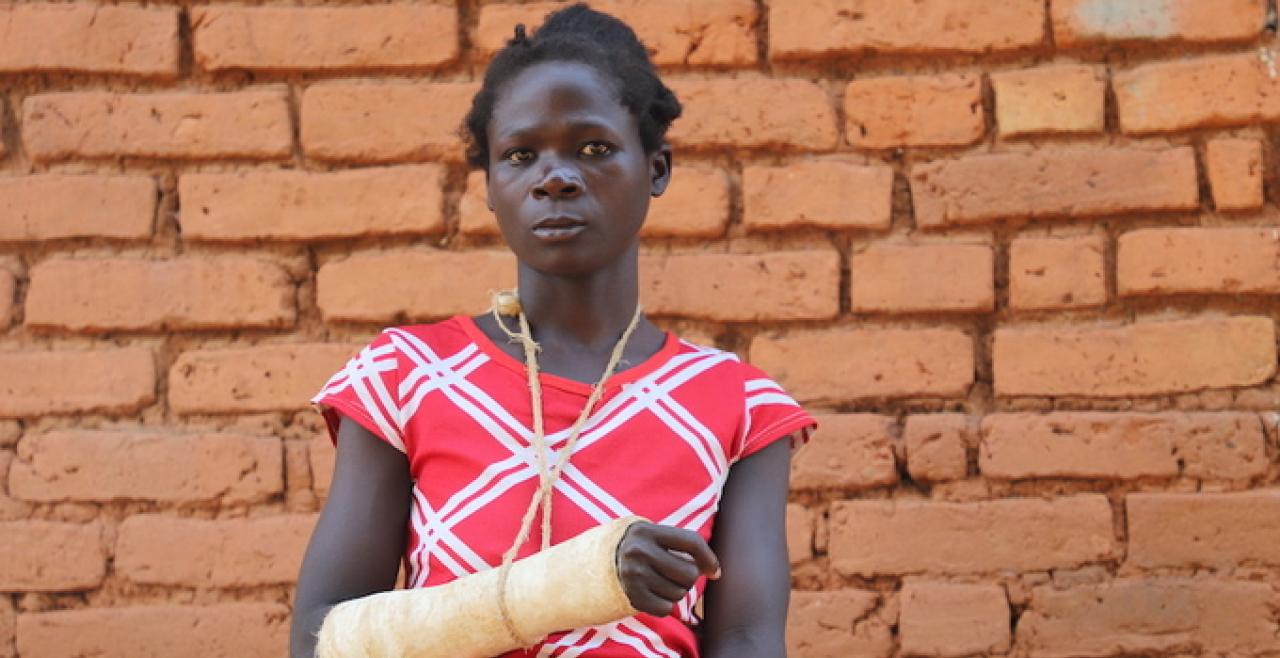 A young woman stands against a brick wall with her arm in a cast